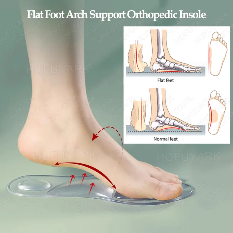Solette in gel di silicone Sol - Women'S Shoes High Arch Support recensione e prezzo